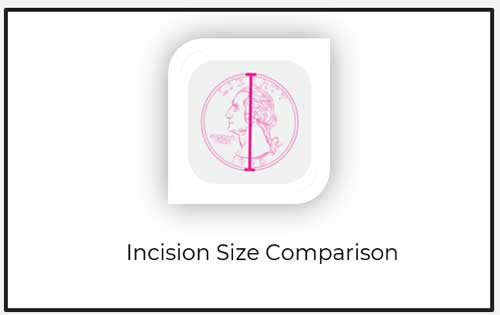 insition size