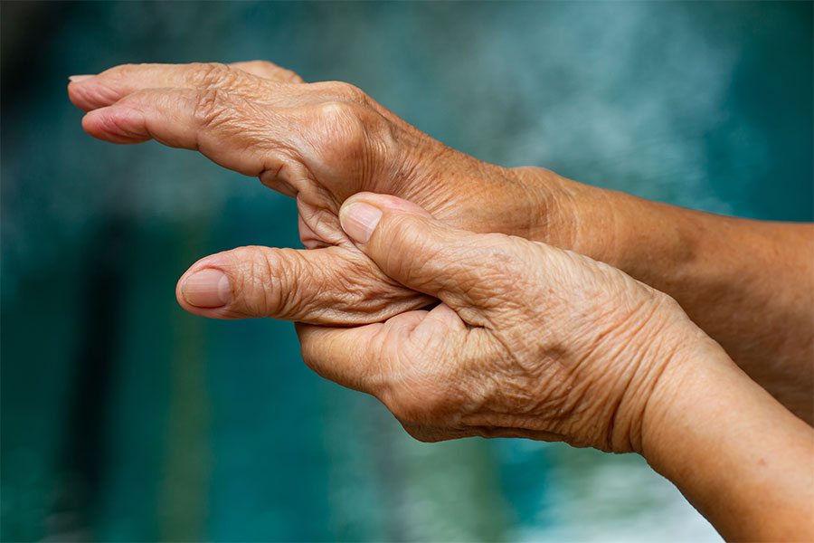 Rheumatoid Arthritis Treatment In San Diego CA The Pain Center